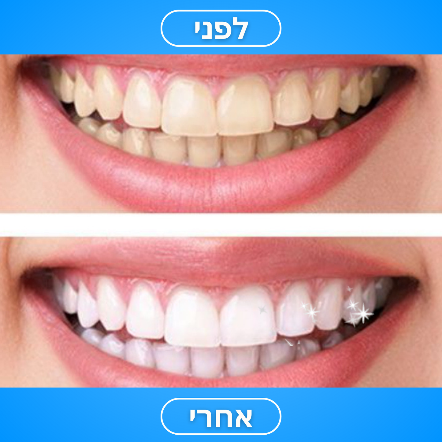 ابتسامة منعشة™ - موس تبييض الأسنان للاستخدام المنزلي