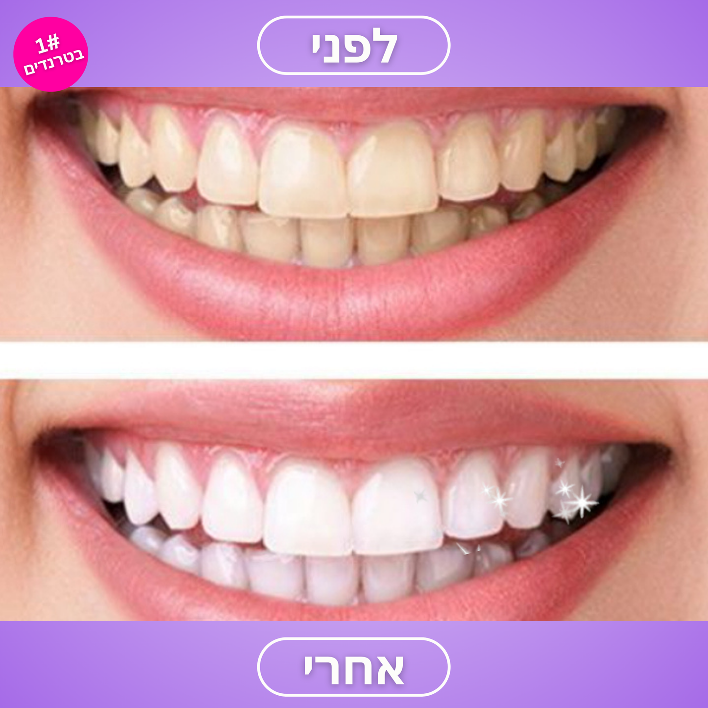 ™FRESH SMILE – מברשת שיניים חדשנית לניקוי יסודי ולחיוך רענן