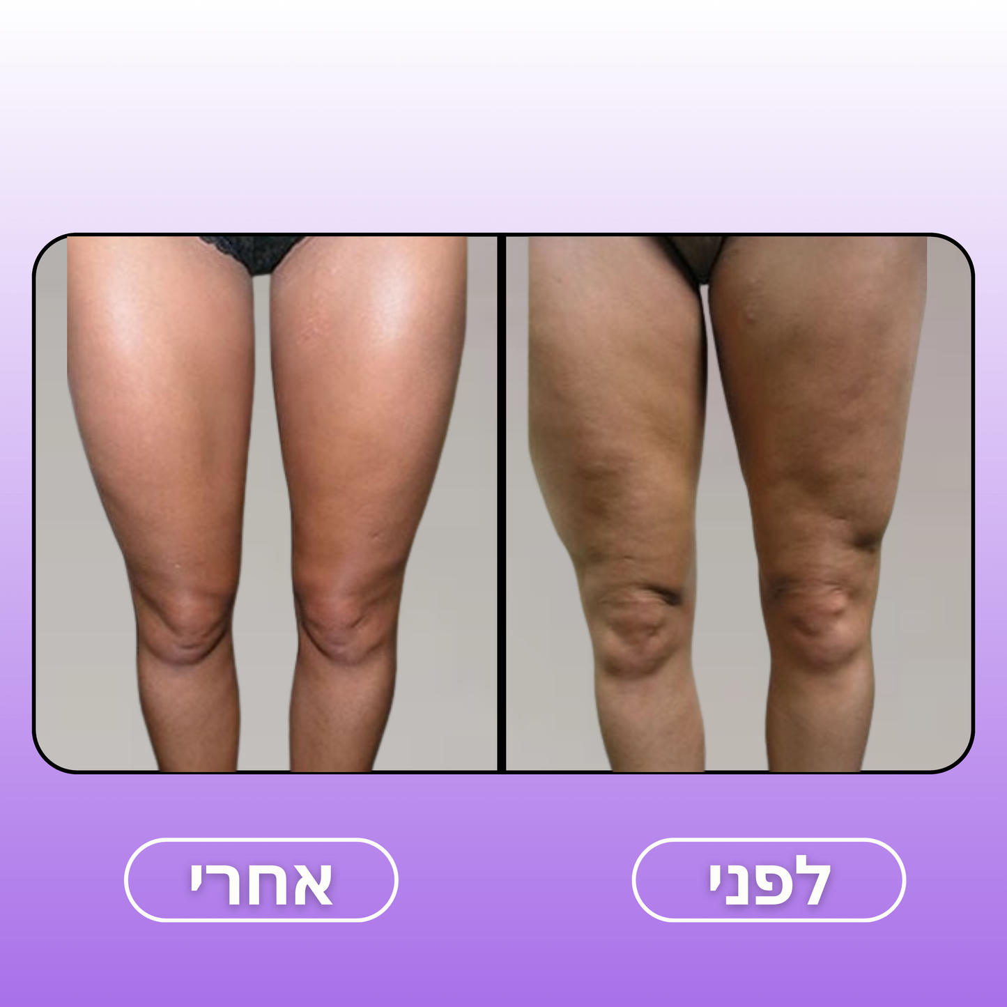 Moodie Smoothy™ – המעסה החדשני בעולם