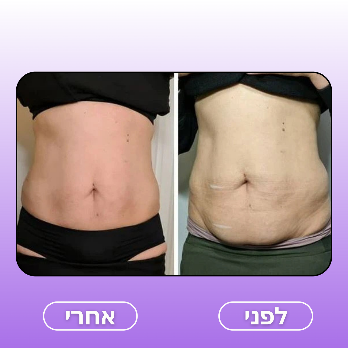 Moodie Smoothy™ – המעסה החדשני בעולם