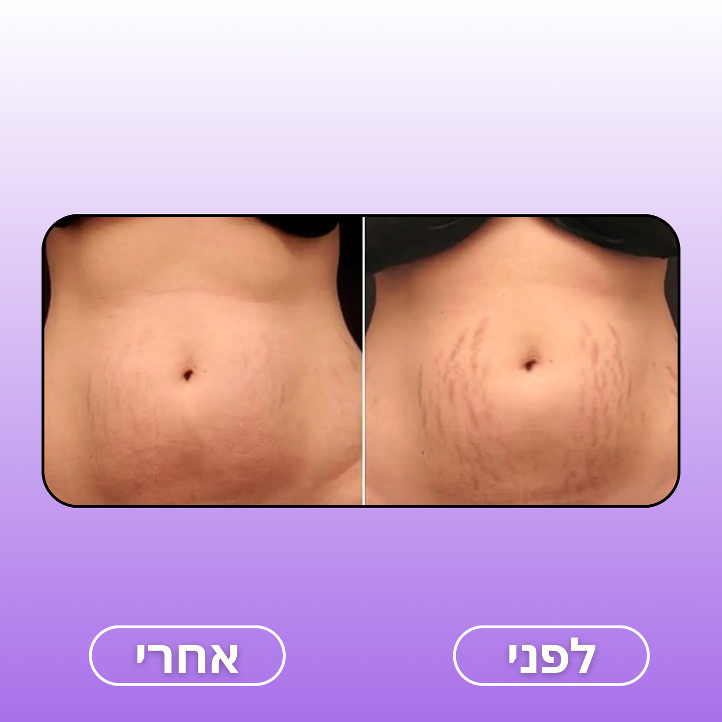 Moodie Smoothy™ – המעסה החדשני בעולם