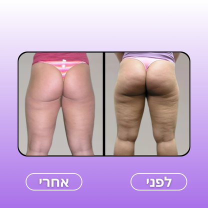 CelluWave™ – המעסה החדשני לעיצוב ומיצוק