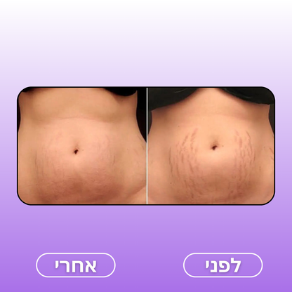 Moodie Smoothy™ – המעסה החדשני בעולם